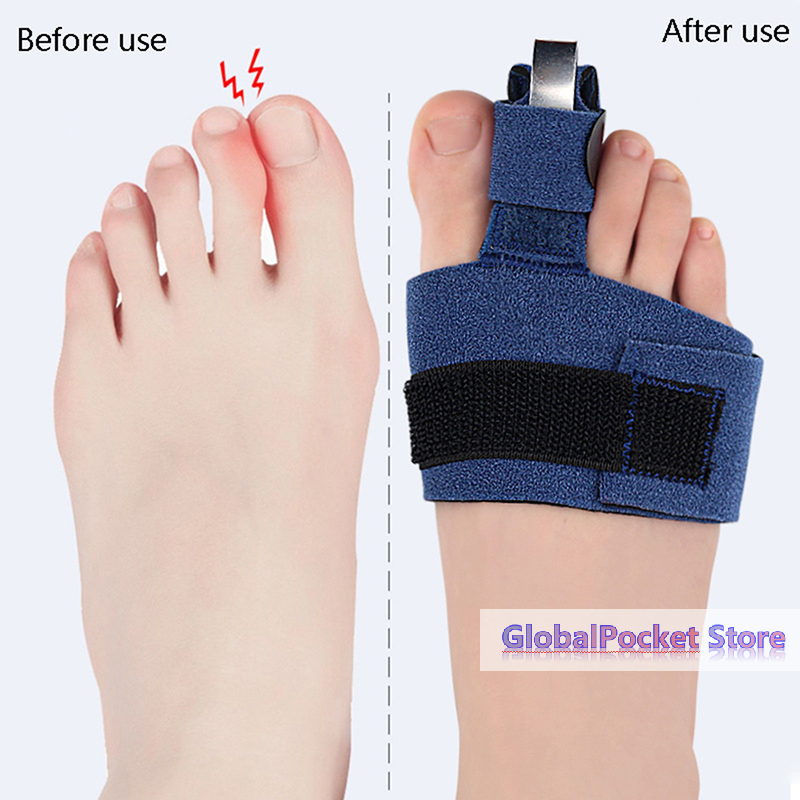 1Pcs Toe Corrector Toe Fractur - Ankle Brace Sock 评论和价格